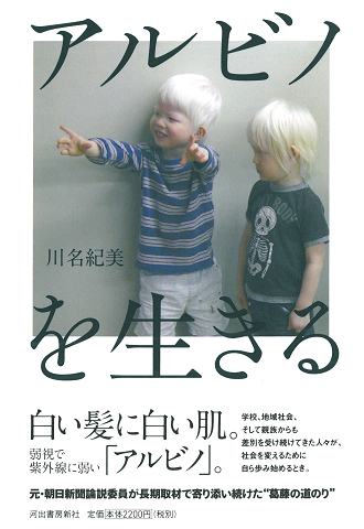 アルビノの日本人の書籍『アルビノを生きる』が発売
