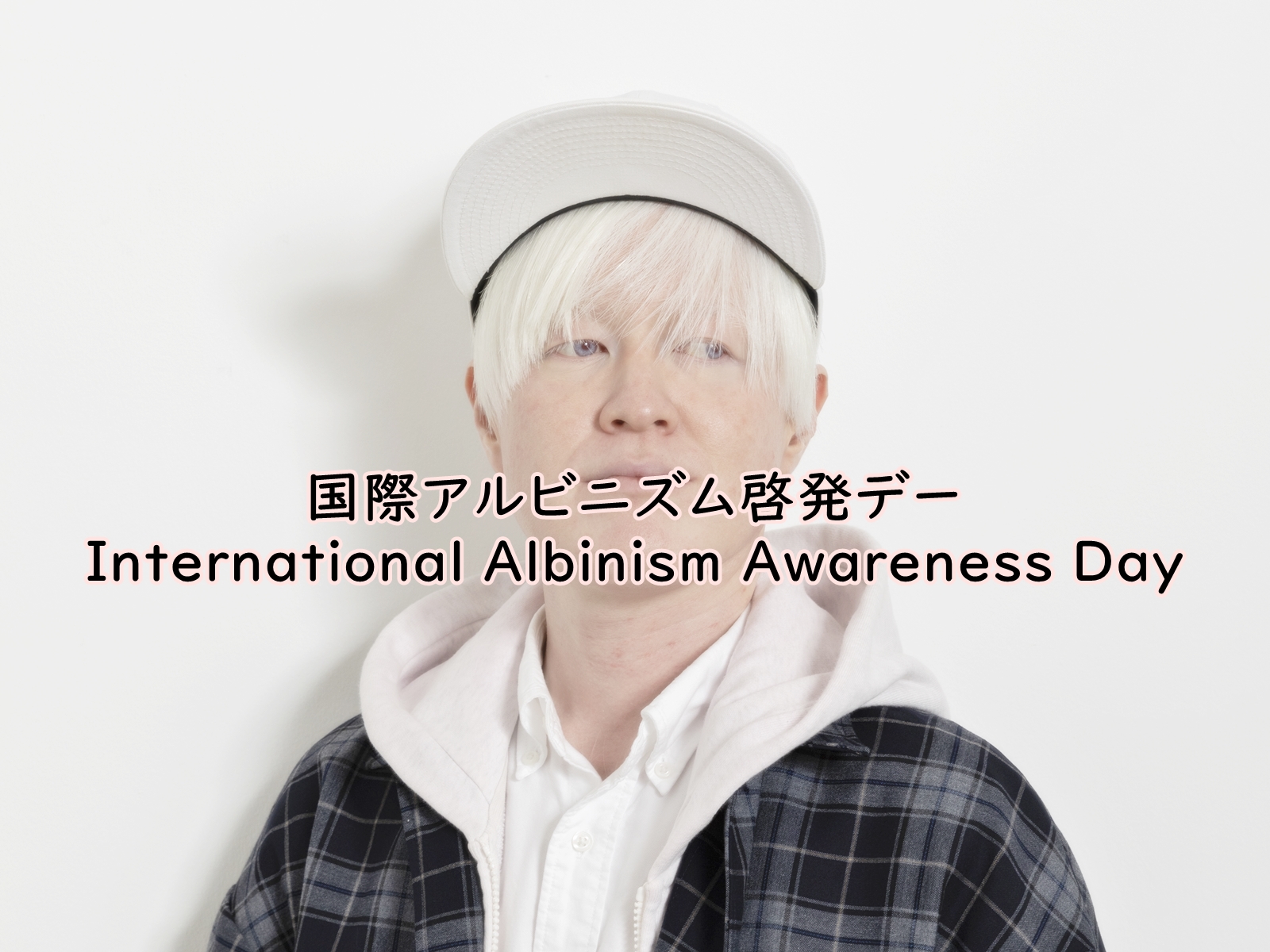 【国際アルビニズム啓発デー】日本でも「アルビノの人々の“いまからみらい”」を一緒に考えて発信しよう