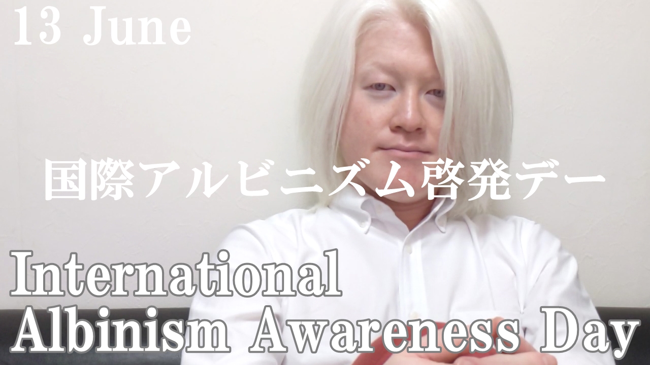 International Albinism Awareness Day 2020 YouTube動画